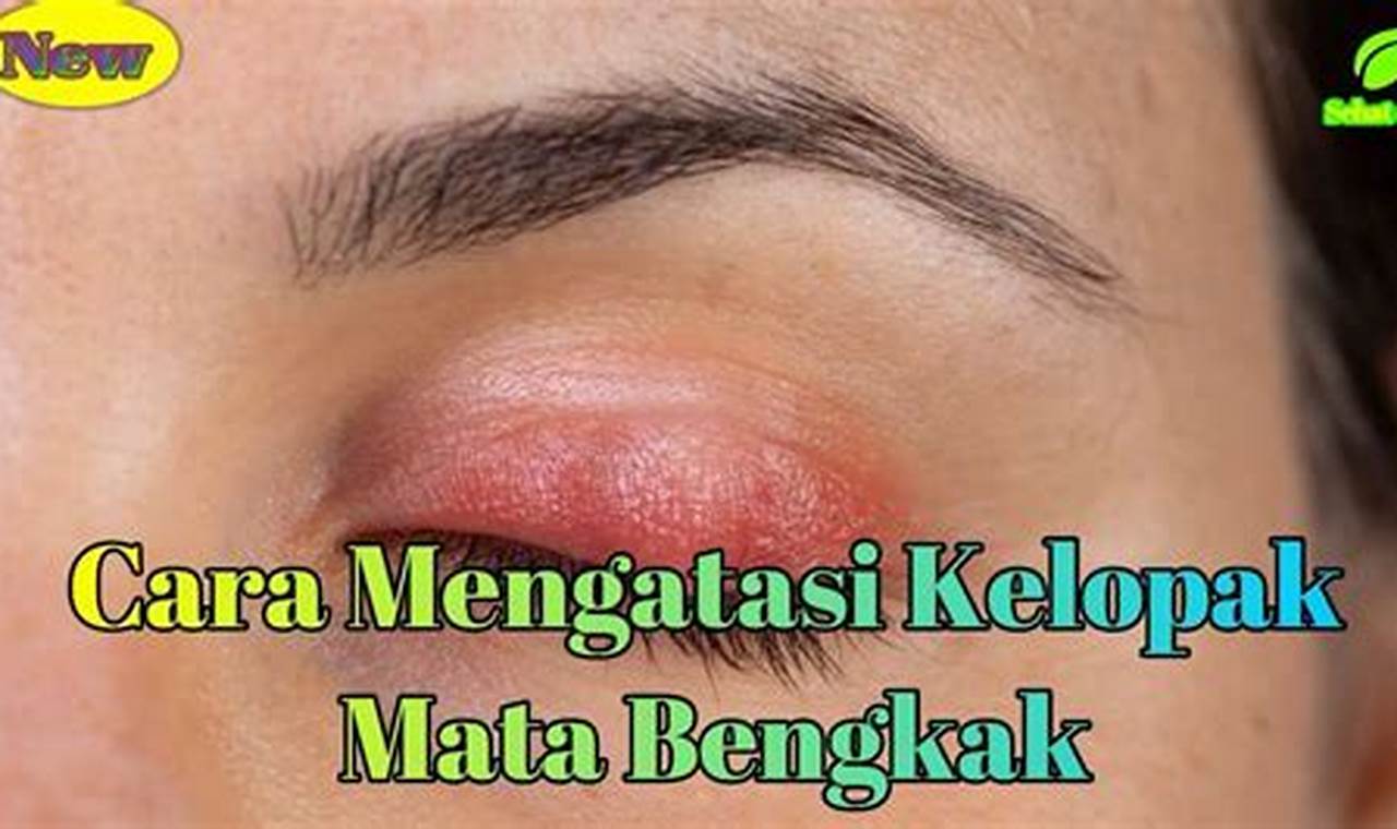 Cara Mengatasi Kelopak Mata Bengkak
